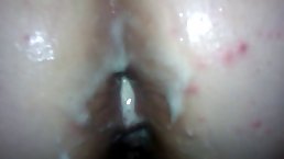 Kinky slut likes to get a large fat penis in her wide open ass, like an animal