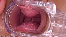 Taissia Shanti is using a gynecologist's tool and fingers while masturbating in front of the camera